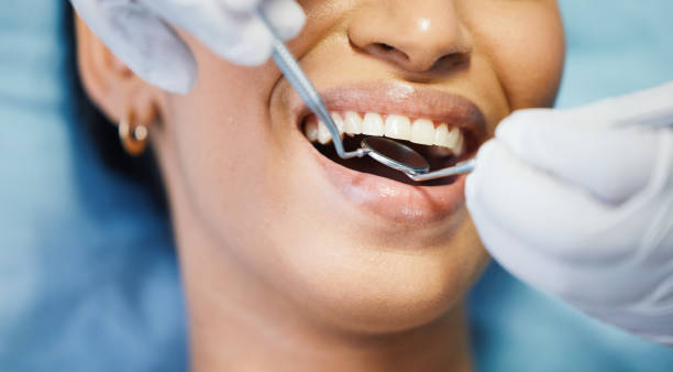 Best Urgent Care for Lost Fillings or Crowns in Deerfield, MI